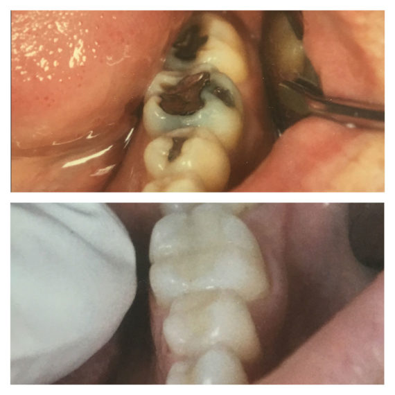 Dental Work Before and After